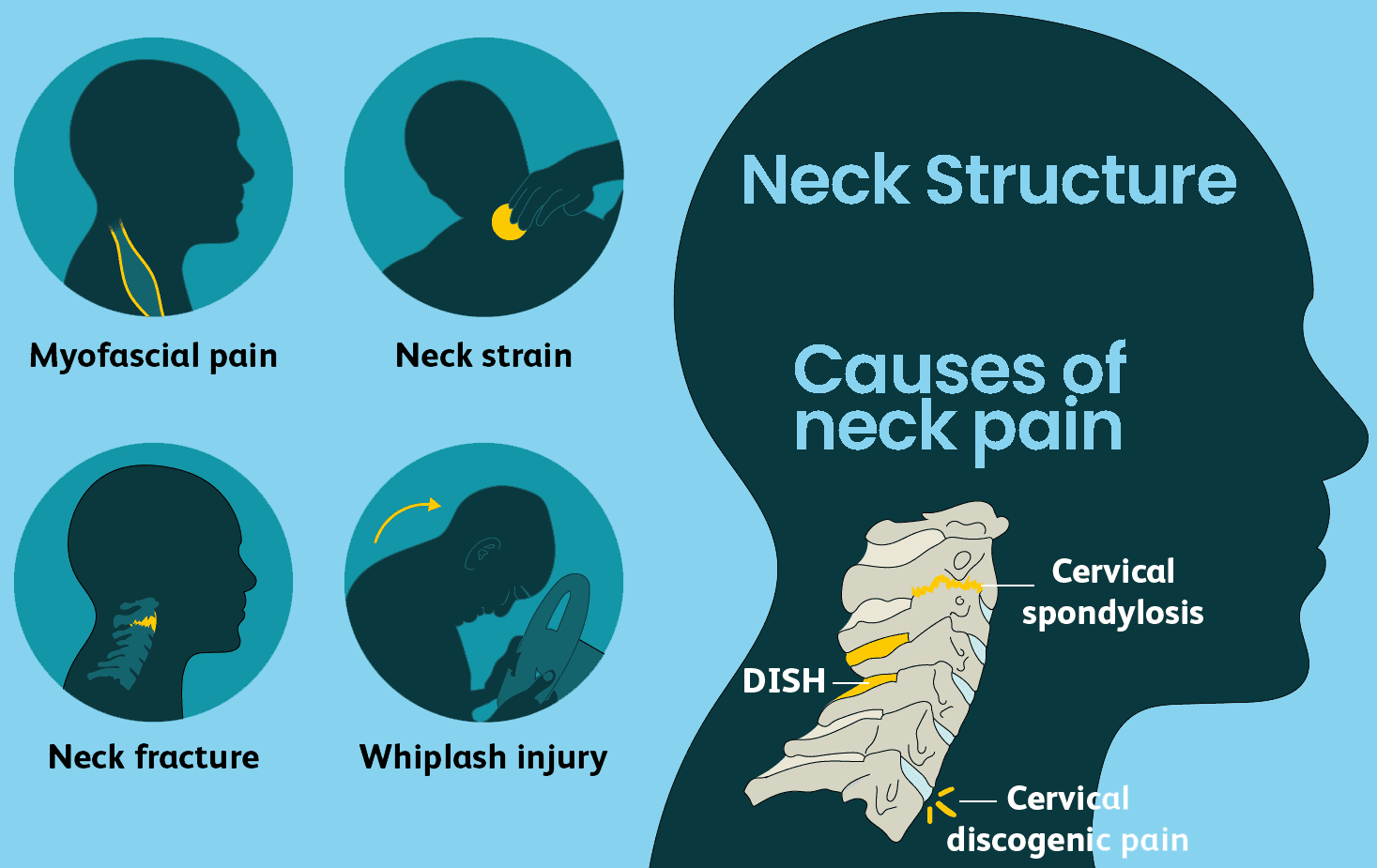 Chronic Neck Pain